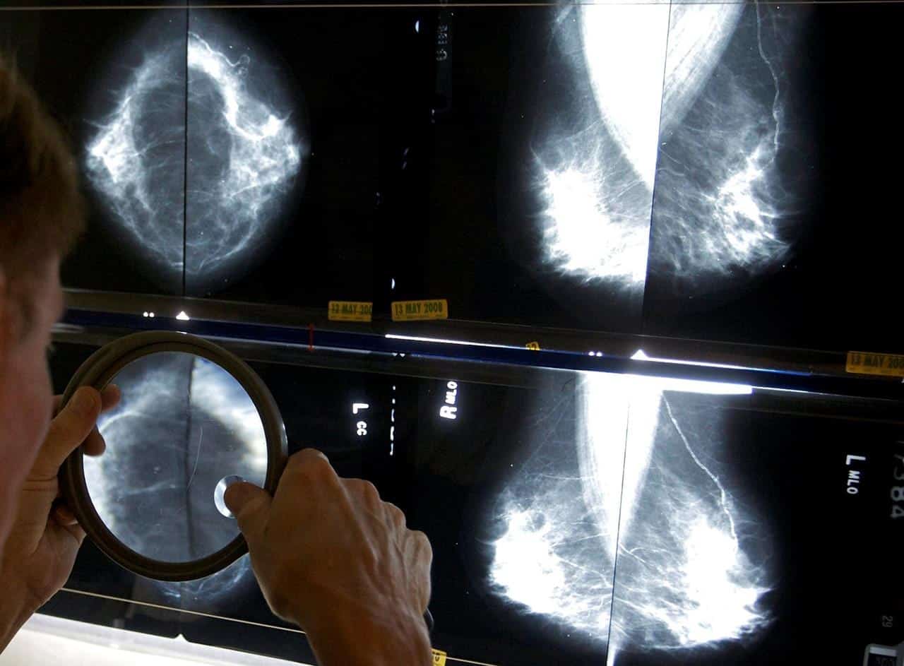 breast cancer screening women canada ontario