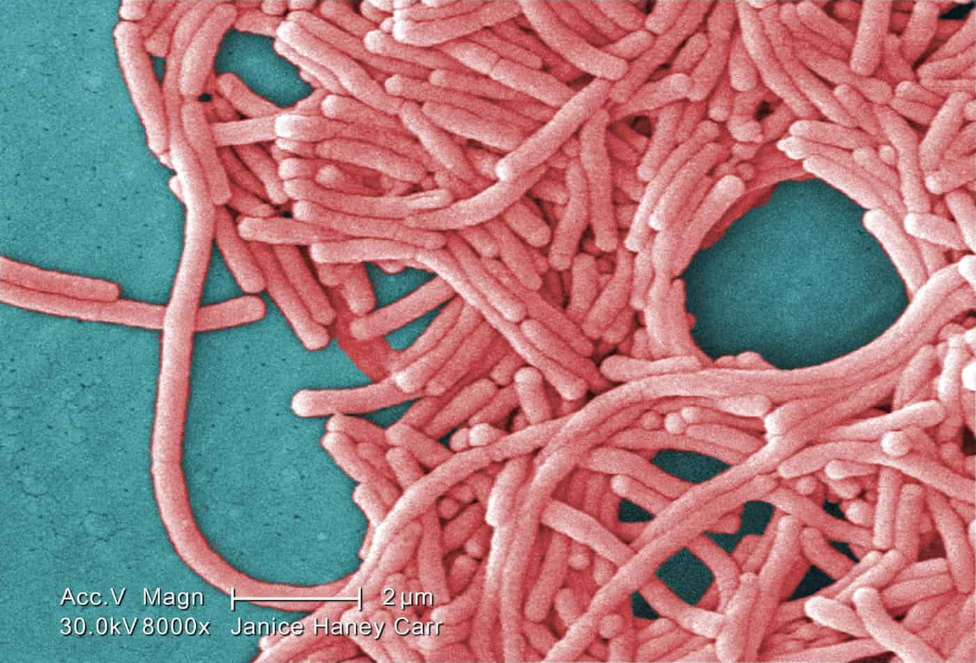 Legionnaires' disease hamilton ontario outbreak