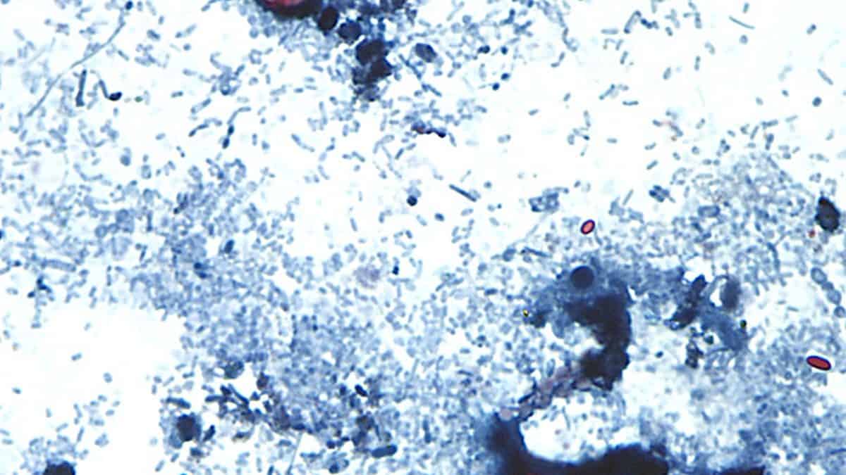 No cyclospora outbreaks reported or tainted lettuce sold in Canada, officials say