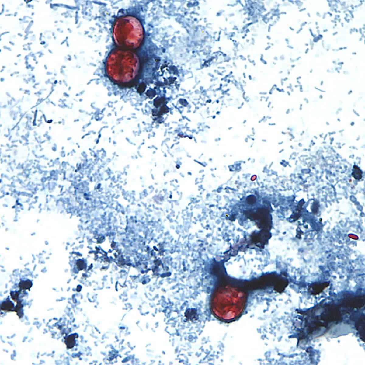 No cyclospora outbreaks reported or tainted lettuce sold in Canada, officials say